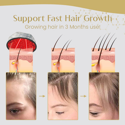 Ceoerty™ Laser Hair Growth Cap